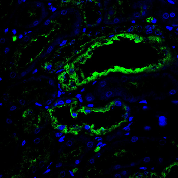 ACAT1 Antibody