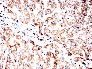 ACAT1 Antibody