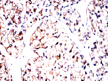 ACAT1 Antibody