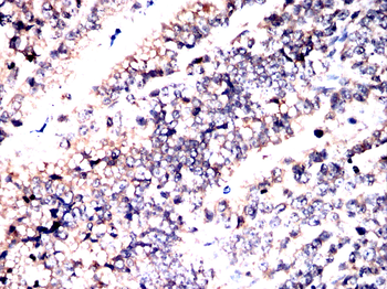 ACAT1 Antibody