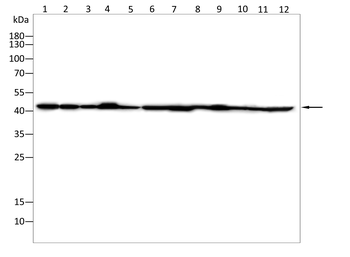 ACAT1 Antibody