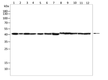 ACAT1 Antibody