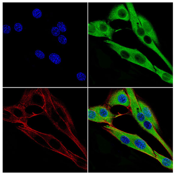 ANP32A Antibody