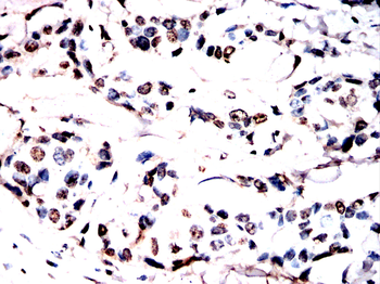 ANP32A Antibody