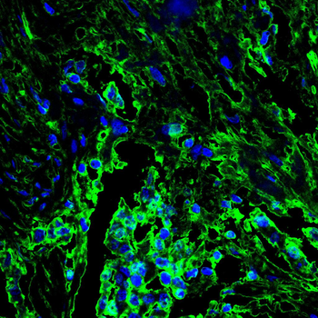 ANP32A Antibody