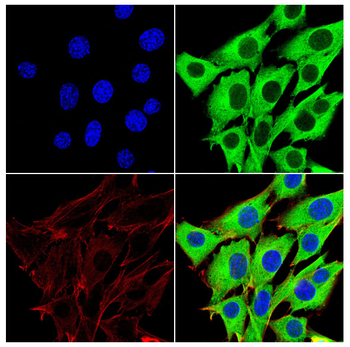 TUBB3 Antibody