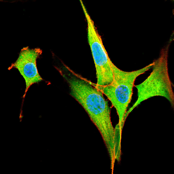 KDM5A Antibody