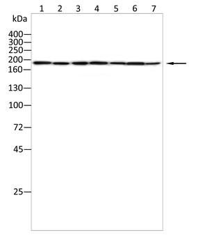 KDM5A Antibody