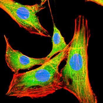 RPTOR Antibody