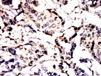 USP9X Antibody