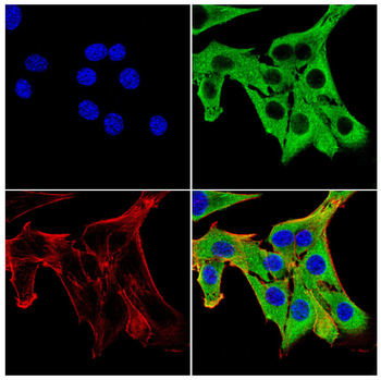 TNNT2 Antibody