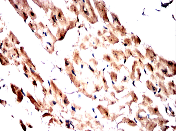 TNNT2 Antibody