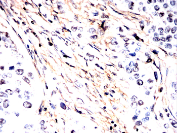 TNNT2 Antibody