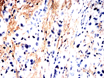 TNNT2 Antibody