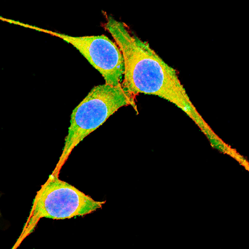 TNNT2 Antibody