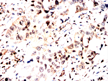 FKBP4 Antibody