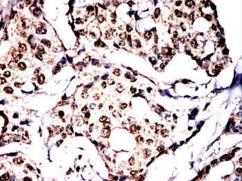 FKBP4 Antibody