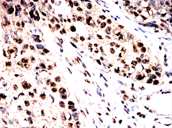 FKBP4 Antibody