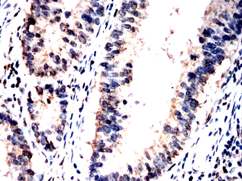FKBP4 Antibody
