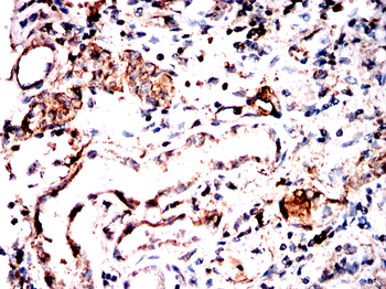 TFPI2 Antibody
