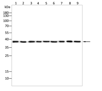 TFPI2 Antibody