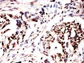 NFATC2 Antibody