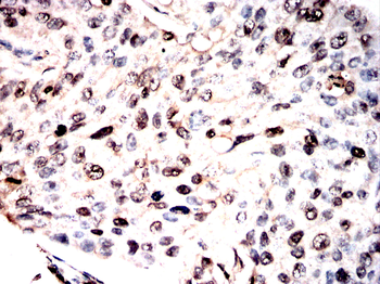 NFATC2 Antibody