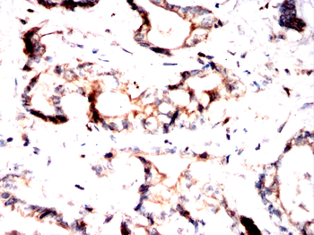 NFATC2 Antibody