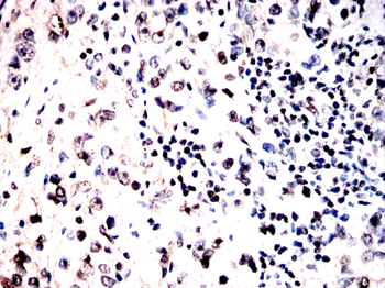 NFATC2 Antibody