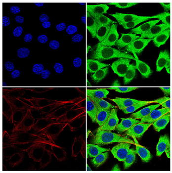 LPL Antibody