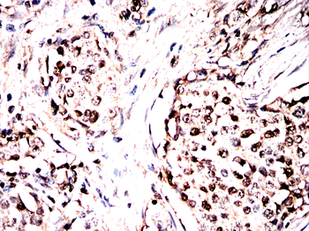 CDT1 Antibody