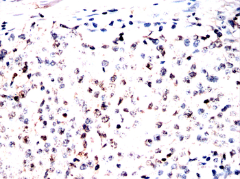 STK4 Antibody