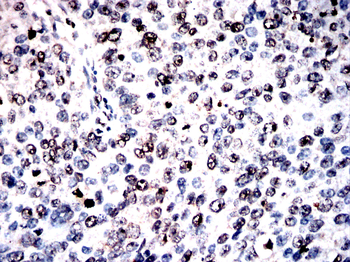 STK4 Antibody