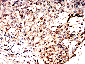 UBA5 Antibody