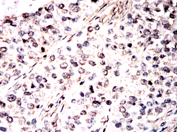 UBA5 Antibody