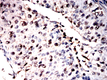 ZYX Antibody