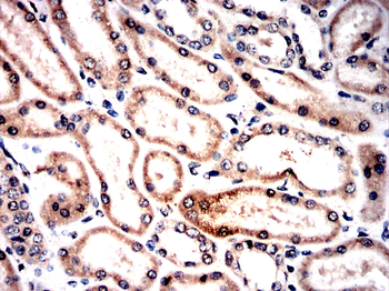ZYX Antibody