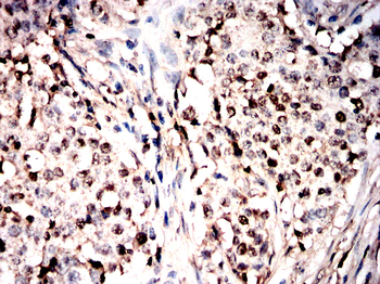 ZYX Antibody