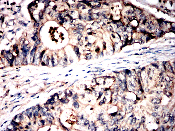 ZYX Antibody