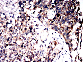 PTPN2 Antibody