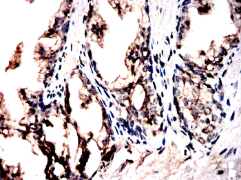 PTPN2 Antibody