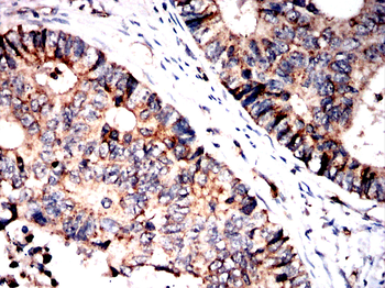PTPN2 Antibody