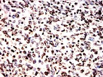 VCP Antibody