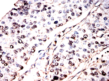 VCP Antibody