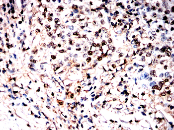 VCP Antibody