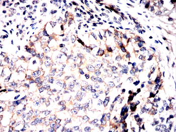 CFL1 Antibody