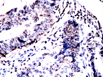 ABL1 Antibody