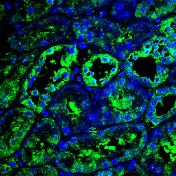 ABL1 Antibody