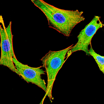 ABL1 Antibody