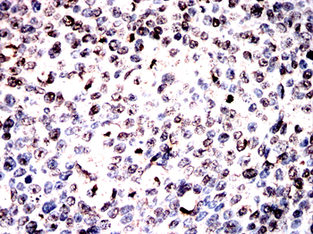 ABL1 Antibody